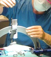 Foto viser kirurg der opererer